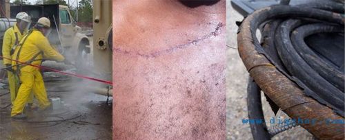 高压软管安全问题